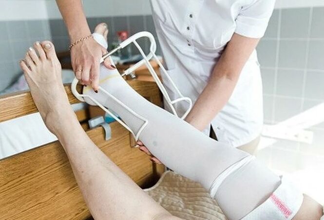 Μετεγχειρητική περίοδο από χειρουργική επέμβαση στις φλέβες των ποδιών