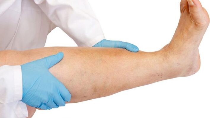 πώς να αναγνωρίσετε την ασθένεια